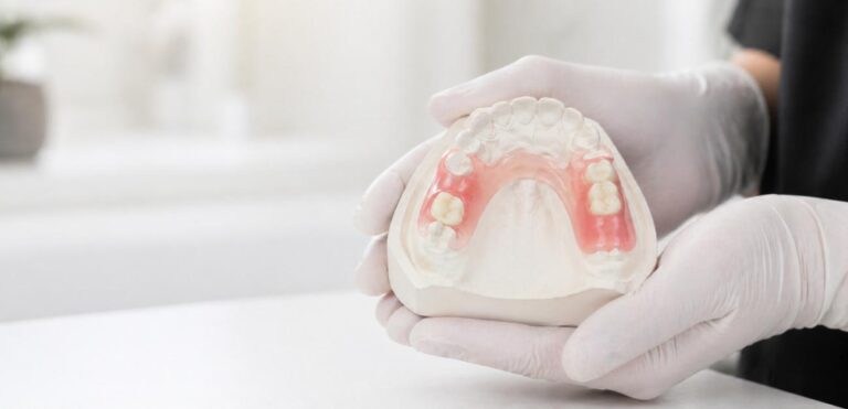 Partial dentures at MK Dental Studio: gloved hands holding a partial denture model in Fulshear, TX